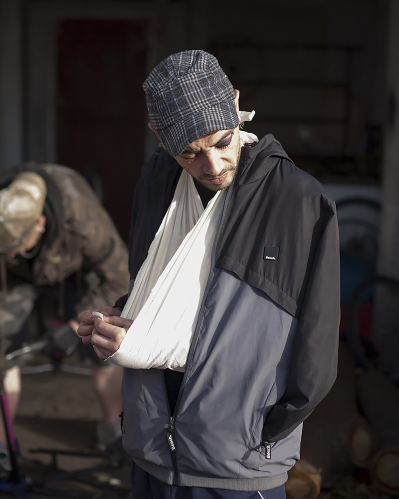A man in a tracksuit with a broken arm and a black eye avoids the gaze of the camera.