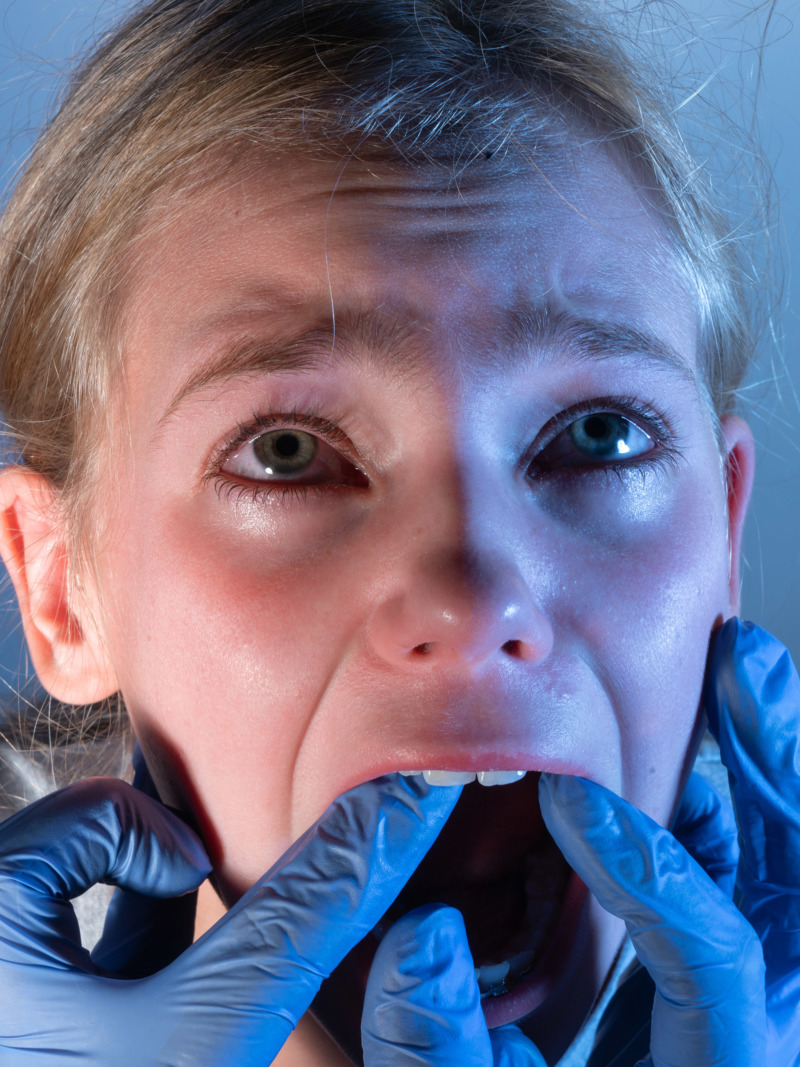A woman's mouth is hled open by hands dressed in blue latex gloves.